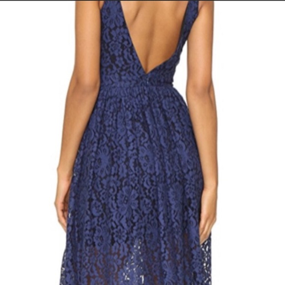 Cynthia Rowley Lace Dress New With Tags - Picture 7 of 7